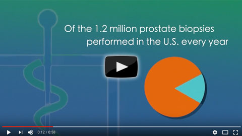 Watch this video debunking myths about a negative prostate biopsy